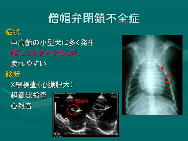 12.僧帽弁閉鎖不全症　症状、診断