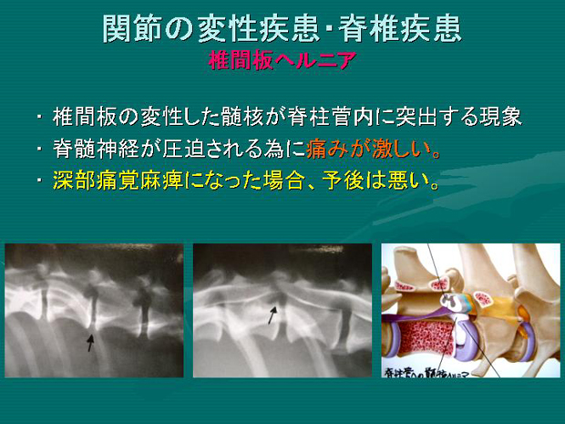 15.関節の変性疾患・脊椎疾患　椎間板ヘルニア