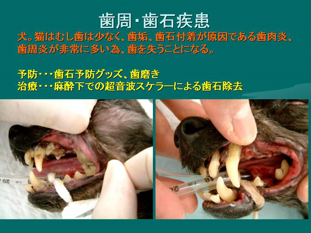 29.歯周・歯石疾患