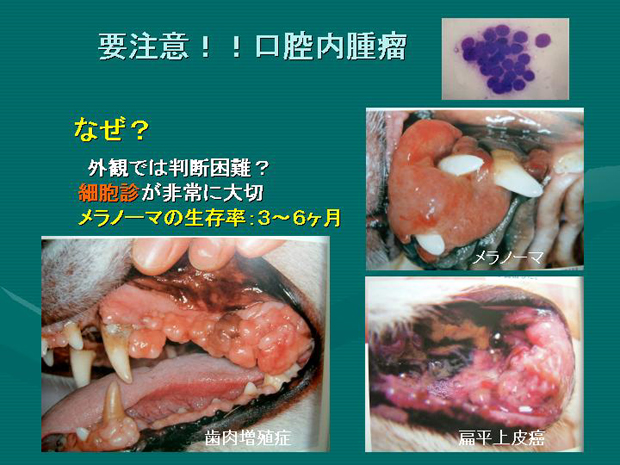 30.要注意！！口腔内腫瘤